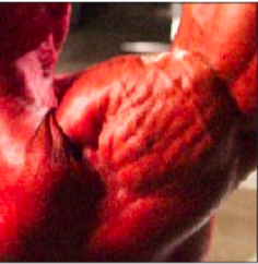 A shoulder with striated muscle fibers