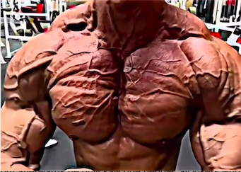 Massive vascular torso